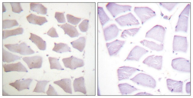 Anti-CRYAB antibody produced in rabbit affinity isolated antibody