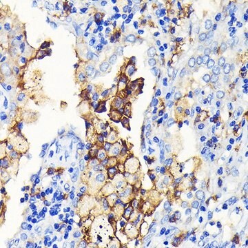 Anti-CD14 antibody produced in rabbit