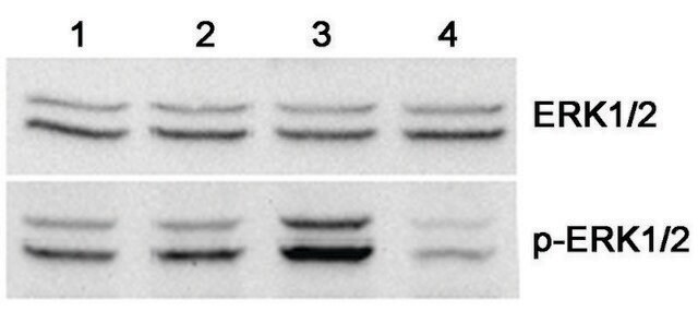 Progranulin mouse recombinant, expressed in HEK 293 cells, FLAG&#174; tagged, &gt;95% (SDS-PAGE)