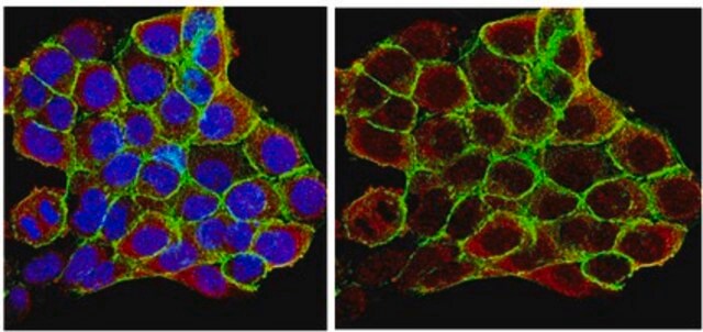 Anti-Heat Shock Protein 90&#945; Antibody from rabbit