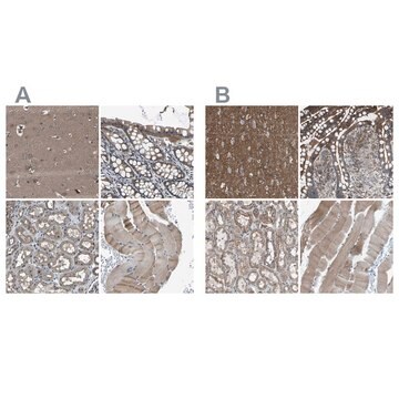 Anti-MYO18A antibody produced in rabbit Prestige Antibodies&#174; Powered by Atlas Antibodies, affinity isolated antibody, buffered aqueous glycerol solution, Ab2