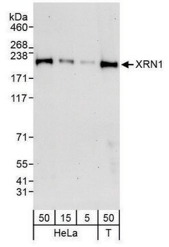 Rabbit anti-XRN1 Antibody, Affinity Purified Powered by Bethyl Laboratories, Inc.