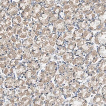 Anti-ZDHHC20 antibody produced in rabbit Prestige Antibodies&#174; Powered by Atlas Antibodies, affinity isolated antibody, buffered aqueous glycerol solution