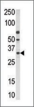 Anti-PPT2 (N-term) antibody produced in rabbit IgG fraction of antiserum, buffered aqueous solution