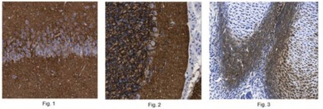 Anti-DSD-1 Antibody, clone 473HD clone 473HD, from rat