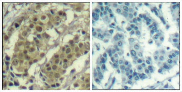 Anti-AKT1 (Ab-450) antibody produced in rabbit affinity isolated antibody