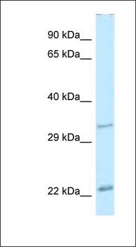 Anti-PDX1 antibody produced in rabbit affinity isolated antibody