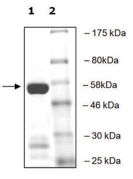 SETD2 active human recombinant, expressed in E. coli, &#8805;70% (SDS-PAGE)