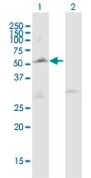 Anti-LPL antibody produced in mouse purified immunoglobulin, buffered aqueous solution