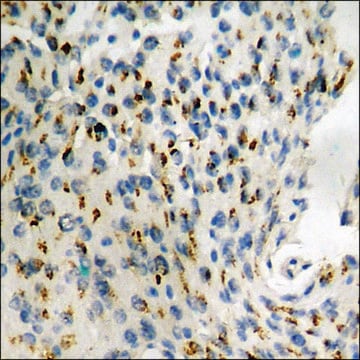 Anti-phospho-CRMP-2 (pThr509) antibody produced in rabbit affinity isolated antibody