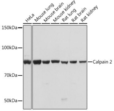 Anti-Calpain 2 Antibody, clone 9Y7I1, Rabbit Monoclonal