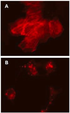 LentiBrite RFP-&#946;-actin Lentiviral Biosensor