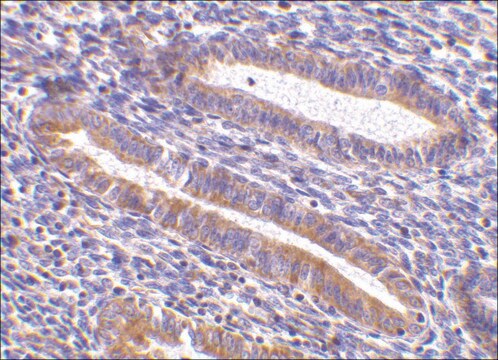 Anti-TIM-1 antibody produced in rabbit affinity isolated antibody, buffered aqueous solution