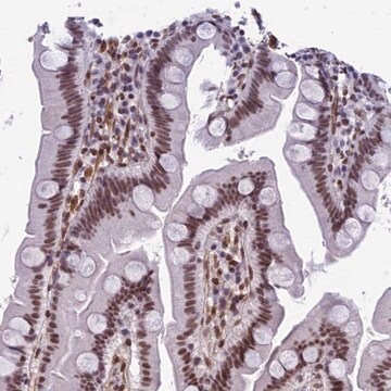 Anti-NIPBL antibody produced in rabbit Prestige Antibodies&#174; Powered by Atlas Antibodies, affinity isolated antibody, buffered aqueous glycerol solution