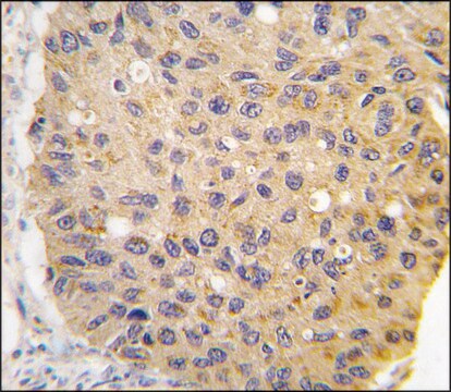 Anti-GHRH (center) antibody produced in rabbit saturated ammonium sulfate (SAS) precipitated, buffered aqueous solution