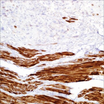 Smoothelin (R4A) Mouse Monoclonal Antibody