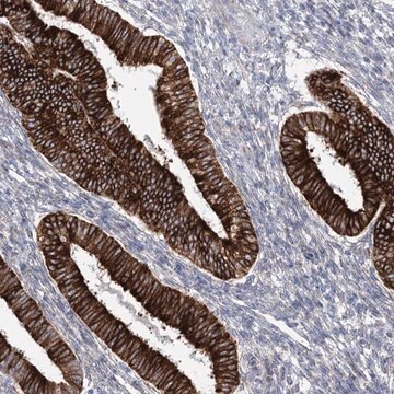 Anti-YTHDC2 antibody produced in rabbit Prestige Antibodies&#174; Powered by Atlas Antibodies, affinity isolated antibody, buffered aqueous glycerol solution