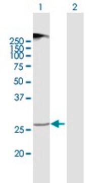 Anti-TMEM38A antibody produced in mouse purified immunoglobulin, buffered aqueous solution