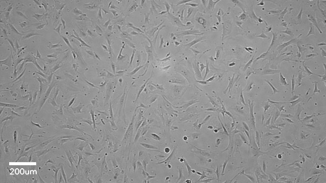 Normal Human Hepatic Stellate Cells; passage 1 Single-Donor Cryopreserved Stellate cells isolated from human livers, high viability, and characterized by cell specific markers