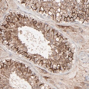 Anti-JAM3 antibody produced in rabbit Prestige Antibodies&#174; Powered by Atlas Antibodies, affinity isolated antibody, buffered aqueous glycerol solution