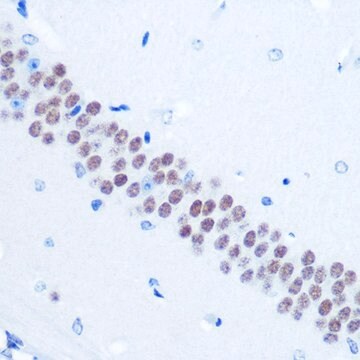 Anti-TLE1 antibody produced in rabbit