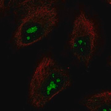 Anti-SMKR1 antibody produced in rabbit Prestige Antibodies&#174; Powered by Atlas Antibodies, affinity isolated antibody