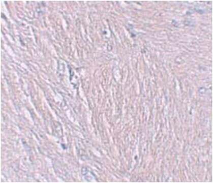 Anti-Synaptopodin Antibody from rabbit, purified by affinity chromatography