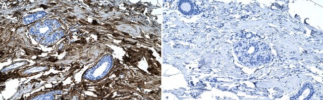 Anti-Collagen VI &#945;3 Antibody, clone 1D6 ZooMAb&#174; Rabbit Monoclonal recombinant, expressed in HEK 293 cells