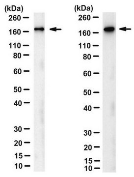 Anti-ASPP2 (TP53BP2) Antibody, clone DX54.10 clone DX54.10, from mouse