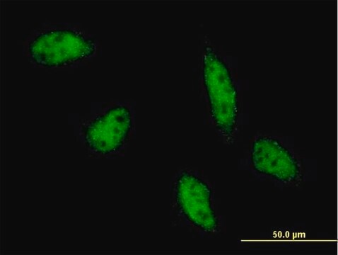 Monoclonal Anti-TFAP2B antibody produced in mouse clone 3G5-1D11, purified immunoglobulin, buffered aqueous solution