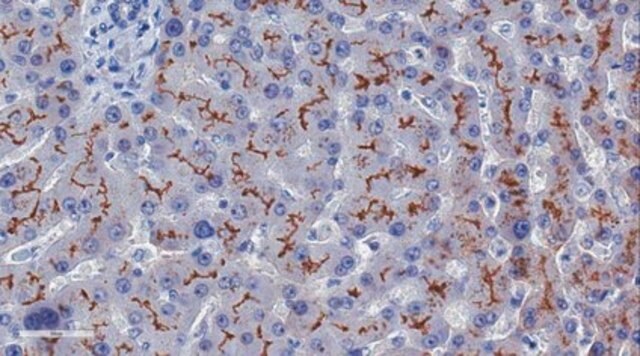 Anti-ABCB11 Antibody, clone 10D4.1 clone 10D4.1, from mouse