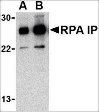 Anti-RPA Interacting Protein (ab2) antibody produced in rabbit affinity isolated antibody, buffered aqueous solution