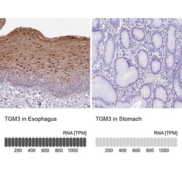 Anti-TGM3 antibody produced in rabbit Prestige Antibodies&#174; Powered by Atlas Antibodies, affinity isolated antibody, buffered aqueous glycerol solution