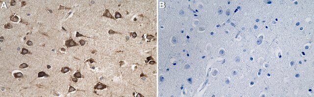 Anti-RAP1GDS1 Antibody, clone 1H6 ZooMAb&#174; Rabbit Monoclonal recombinant, expressed in HEK 293 cells