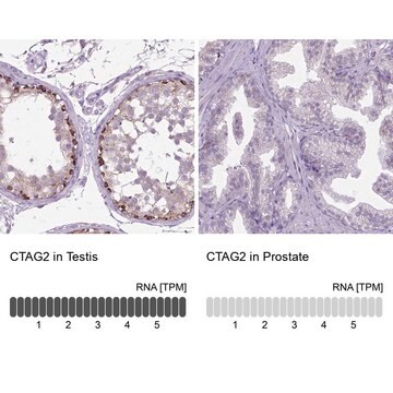 Anti-CTAG2 antibody produced in rabbit Prestige Antibodies&#174; Powered by Atlas Antibodies, affinity isolated antibody, buffered aqueous glycerol solution