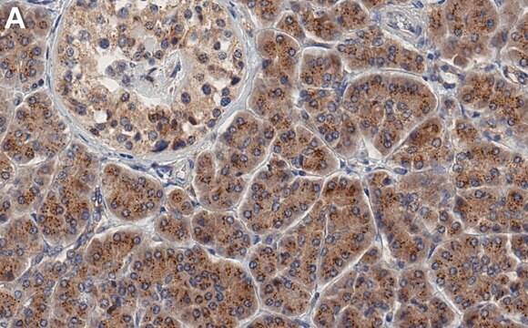 Anti-SLC12A4 Antibody, clone 1F16 ZooMAb&#174; Rabbit Monoclonal recombinant, expressed in HEK 293 cells