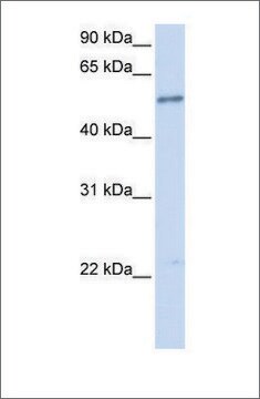 Anti-IL1RL1 antibody produced in rabbit affinity isolated antibody