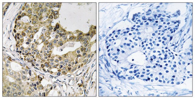 Anti-NXPH1 antibody produced in rabbit affinity isolated antibody