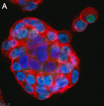 Anti-GLS2 Antibody, clone 3G12 ZooMAb&#174; Rabbit Monoclonal recombinant, expressed in HEK 293 cells