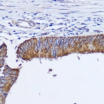 Anti- RhoA antibody produced in rabbit