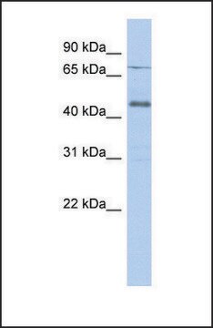 Anti-USP12 antibody produced in rabbit affinity isolated antibody