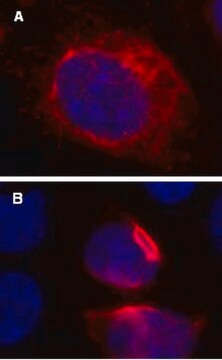 LentiBrite RFP-Vimentin Lentiviral Biosensor