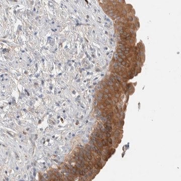 Anti-DEPTOR antibody produced in rabbit Prestige Antibodies&#174; Powered by Atlas Antibodies, affinity isolated antibody, buffered aqueous glycerol solution, Ab2