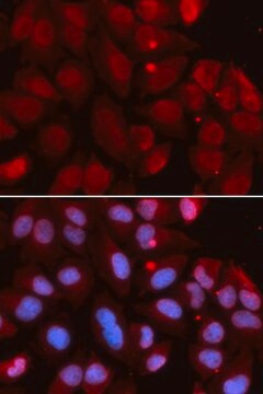 Anti- RAG2 antibody produced in rabbit