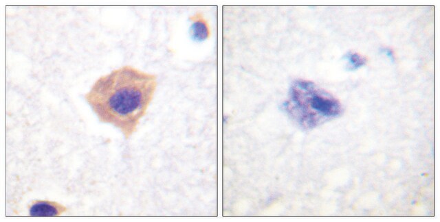 Anti-Catalase antibody produced in rabbit affinity isolated antibody