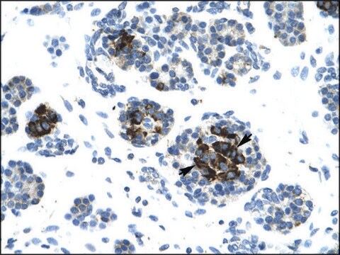 Anti-LIG4 antibody produced in rabbit IgG fraction of antiserum