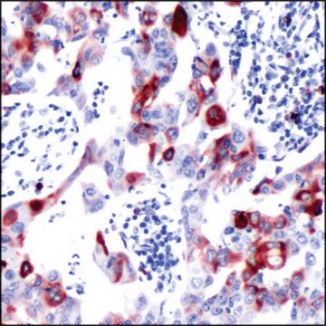 Anti-S6 Ribosomal Protein (phospho S240/244) antibody, Rabbit monoclonal recombinant, expressed in proprietary host, clone SP45, affinity isolated antibody