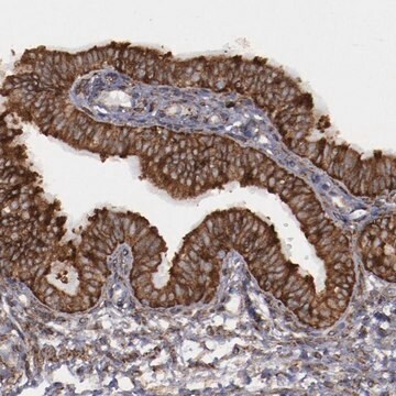 Anti-ERLIN2 antibody produced in rabbit Prestige Antibodies&#174; Powered by Atlas Antibodies, affinity isolated antibody, buffered aqueous glycerol solution