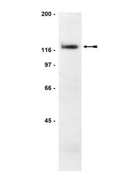 Anti-FAK Antibody, clone 2A7 clone 2A7, Upstate&#174;, from mouse