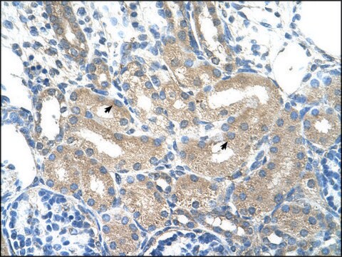 Anti-ADH1B antibody produced in rabbit IgG fraction of antiserum